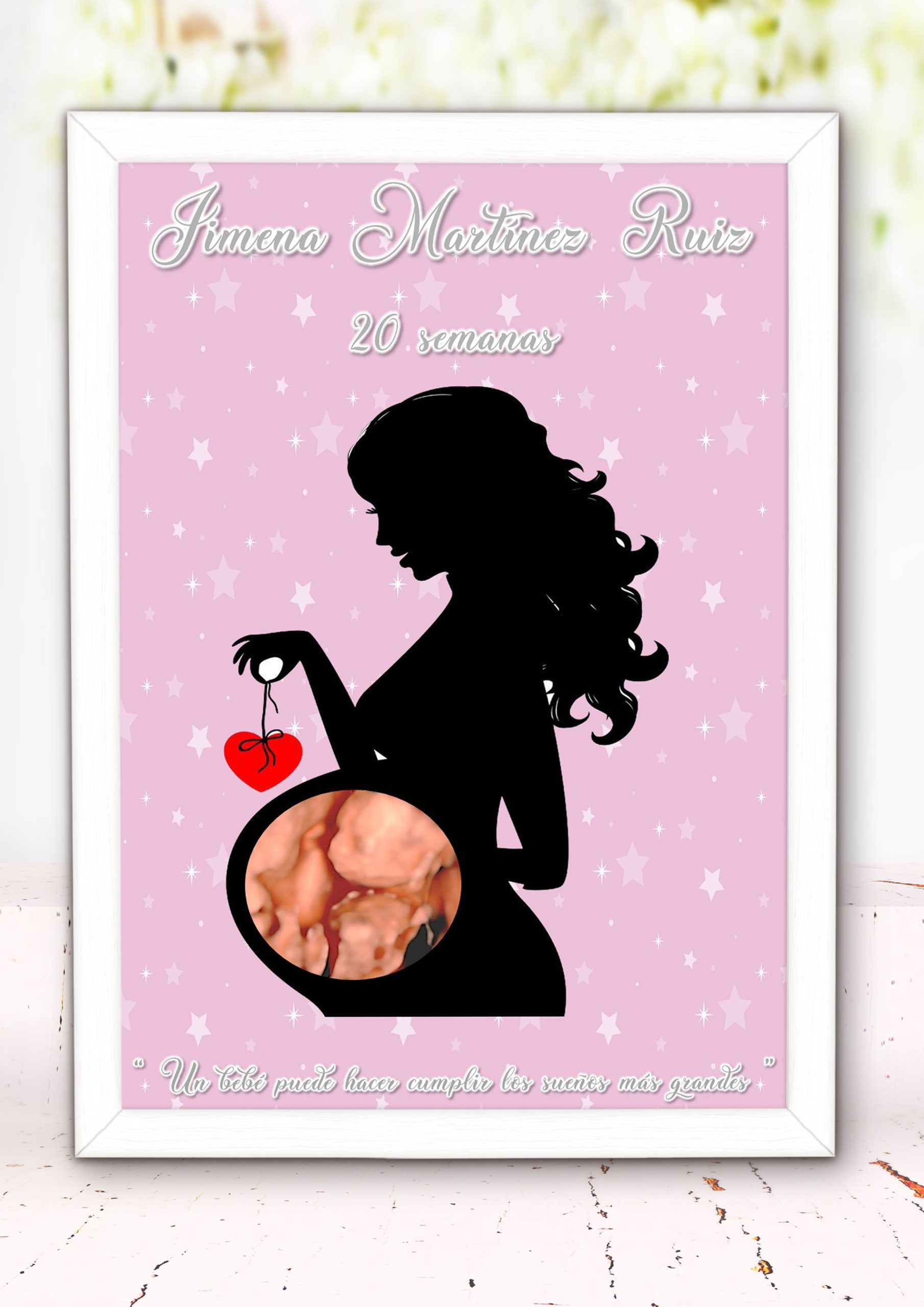 Lamina Personalizada con Ecografía 001