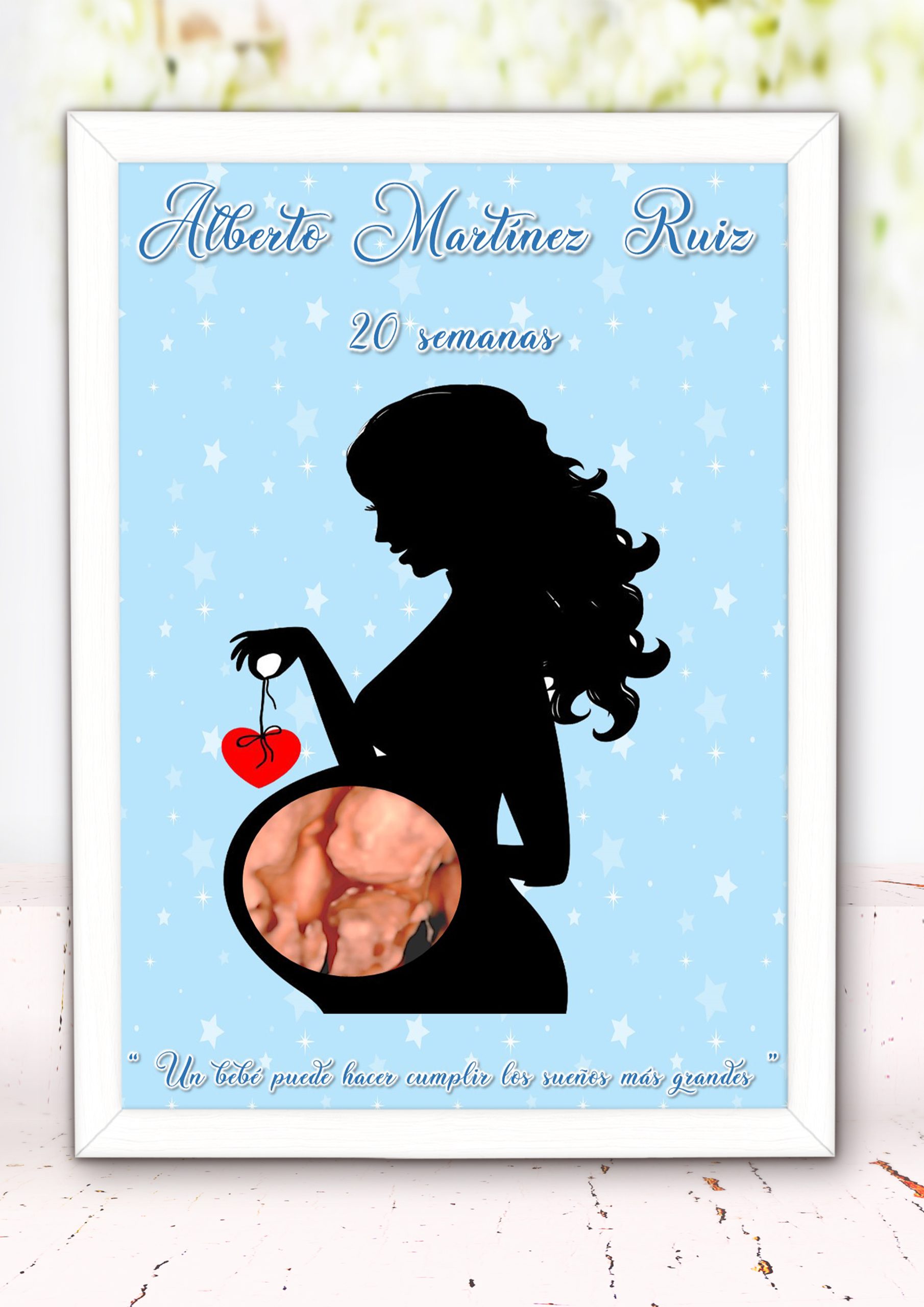 Lamina Personalizada con Ecografía 001 - Imagen 5