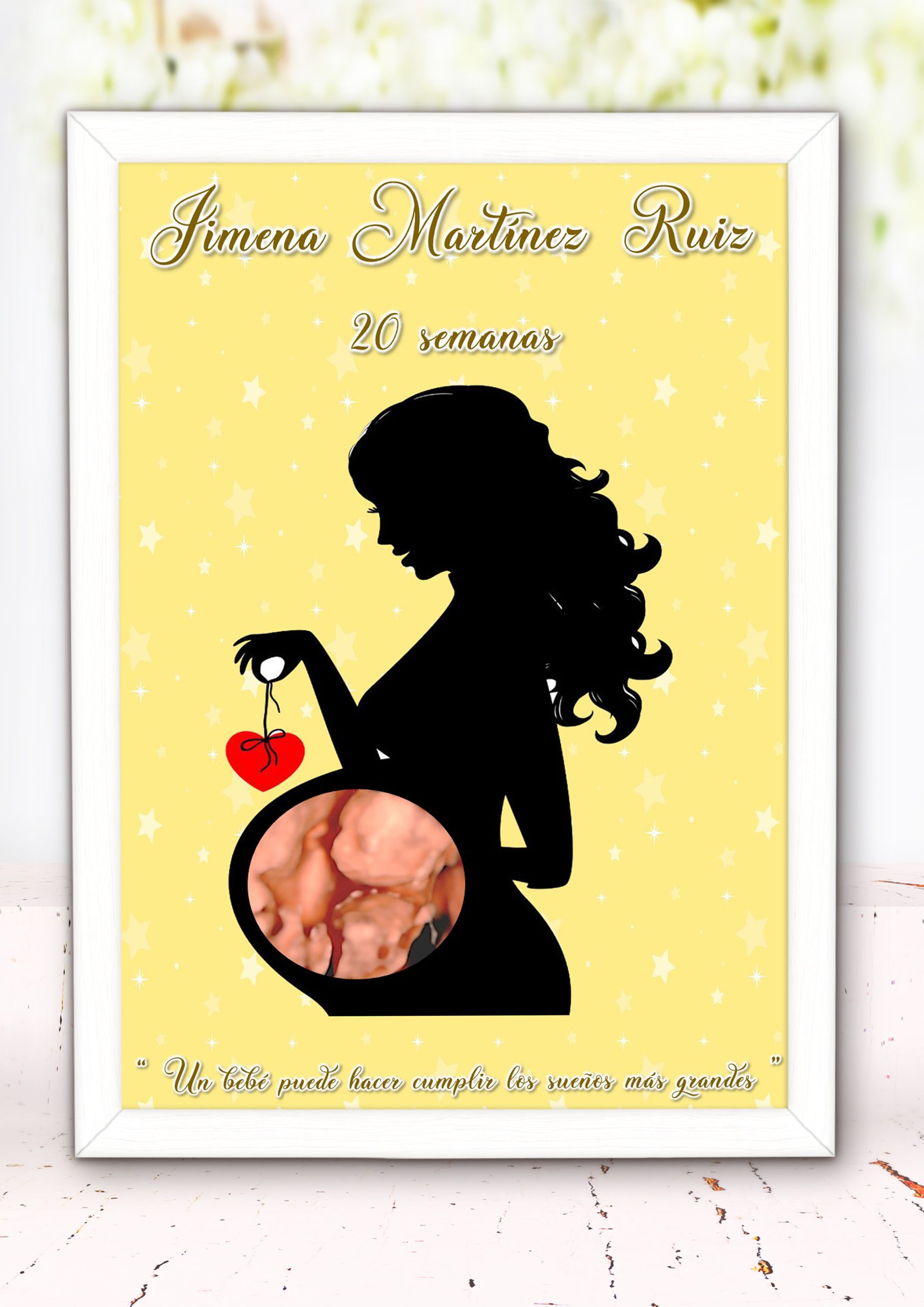 Lamina Personalizada con Ecografía 001 - Imagen 3