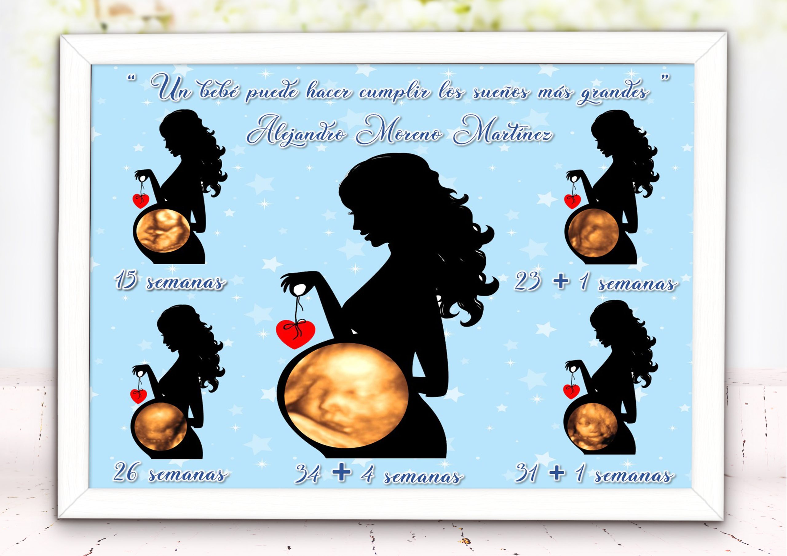 Lamina Personalizada con 5 Ecografías - Imagen 3