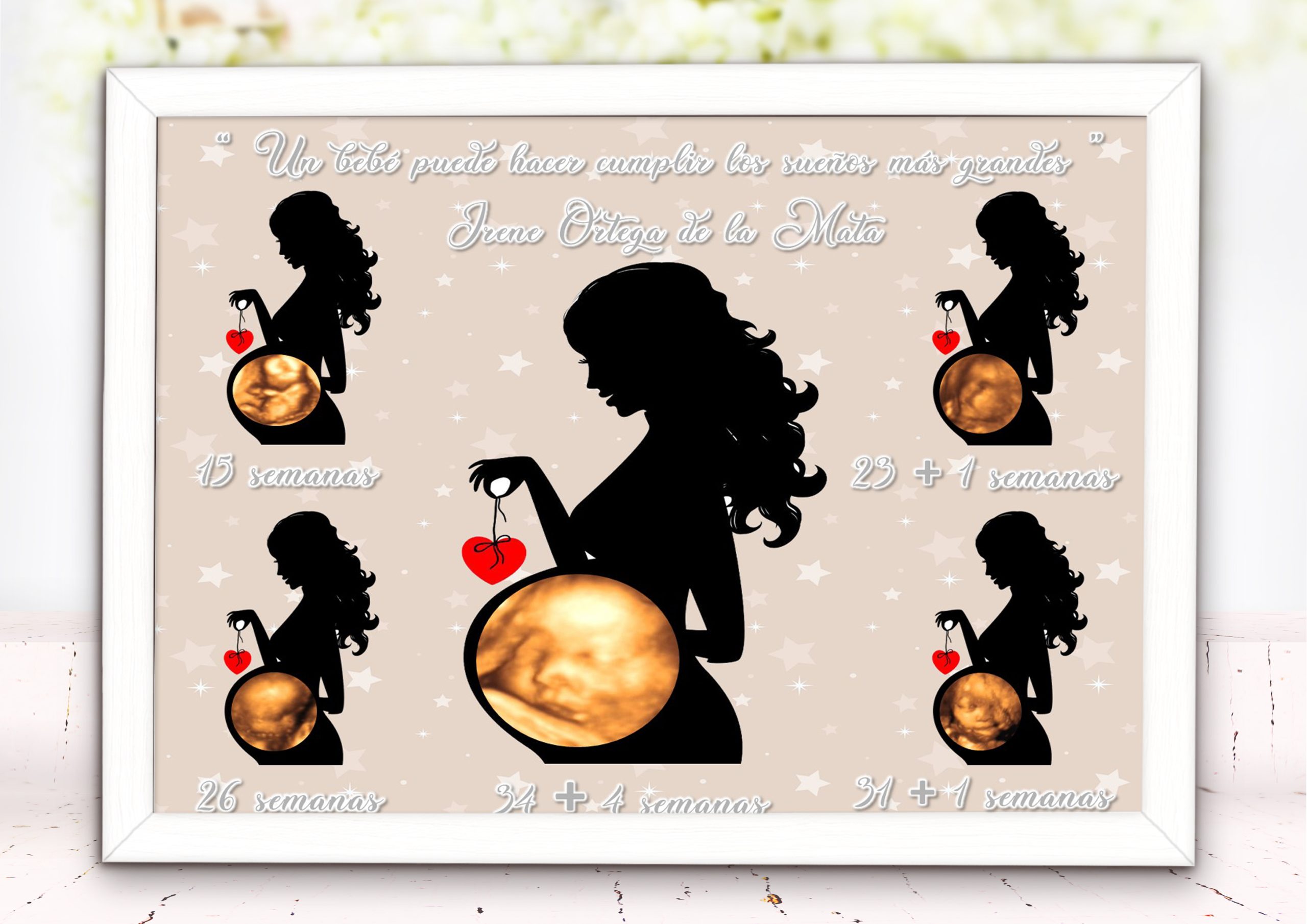 Lamina Personalizada con 5 Ecografías - Imagen 2