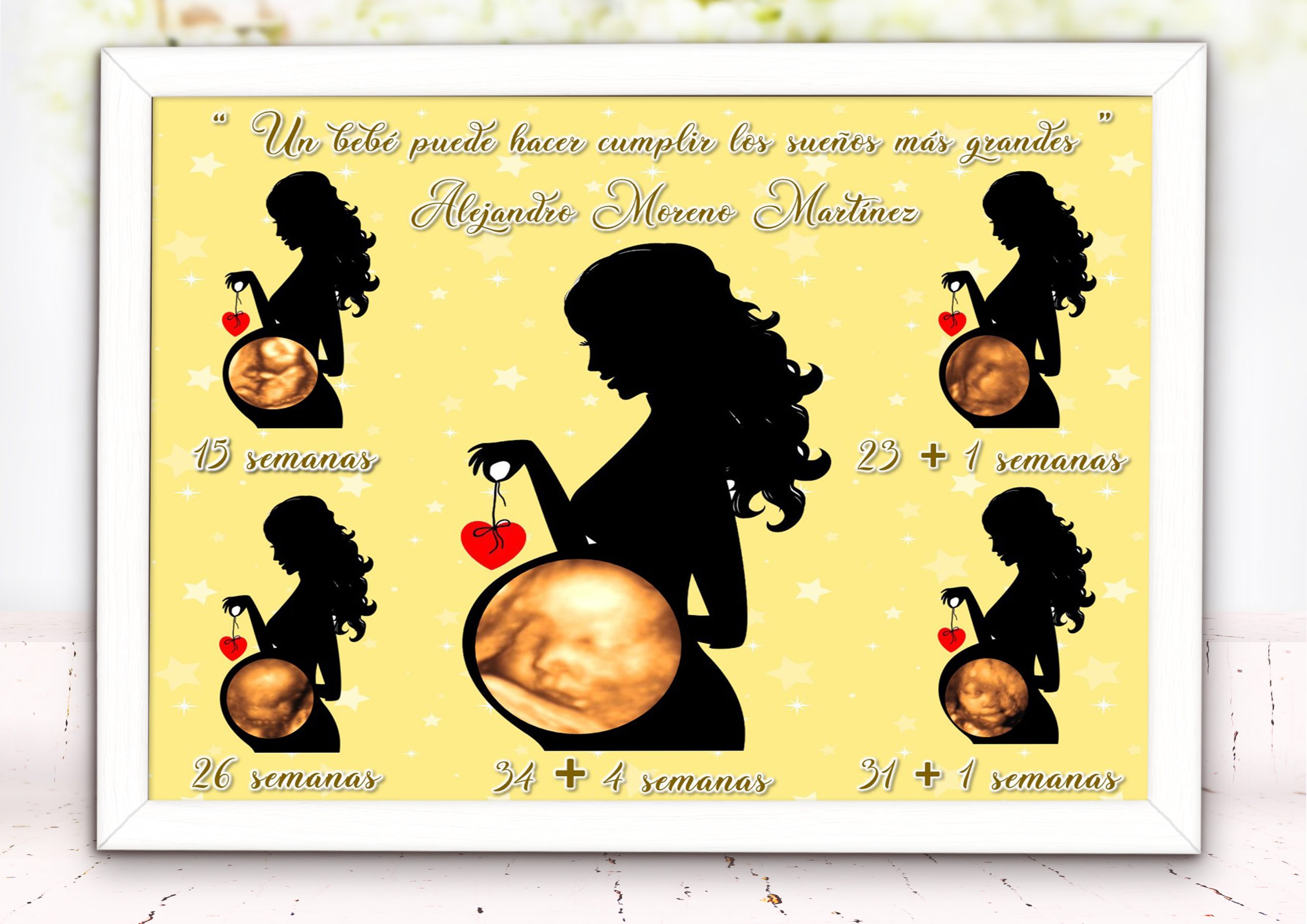 Lamina Personalizada con 5 Ecografías - Imagen 5